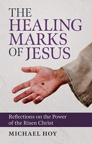 The Healing Marks of Jesus: Reflections on the Power of the Risen Christ